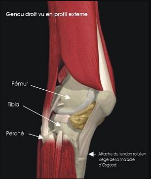 localisation osgood schlatter